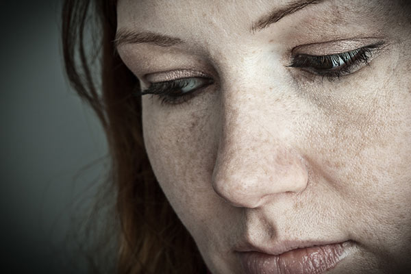 Eine Frau mit Sommersprossen sieht seitlich nach unten.